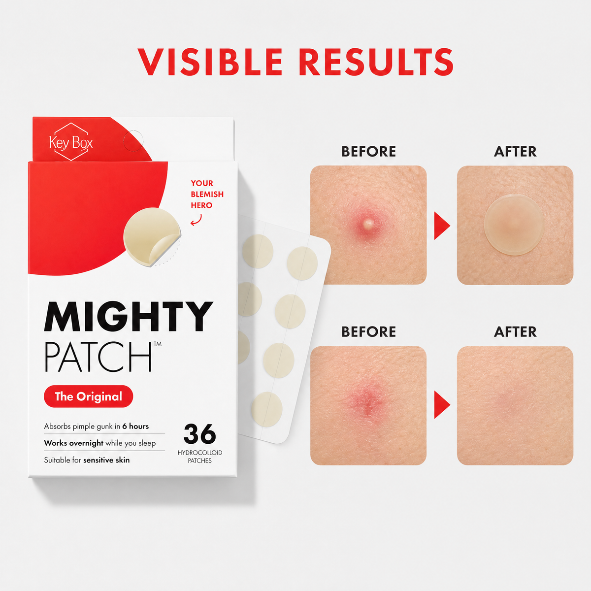 Parche hidrocoloide para imperfecciones - 75unid